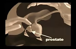 Eesnäärme massaaži võtted