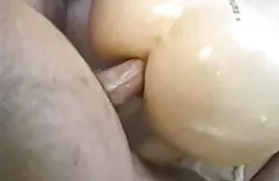 Anaalprits