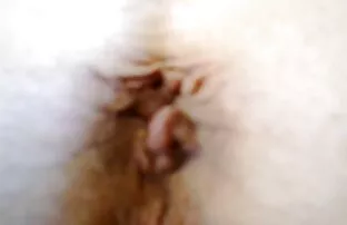 Haigutamine