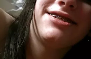 Noored breketitega teismelised