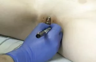 Augustamine 1